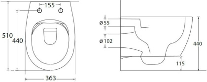 Подвесной унитаз Allen Brau Fantasy 4.11004.IV айвори